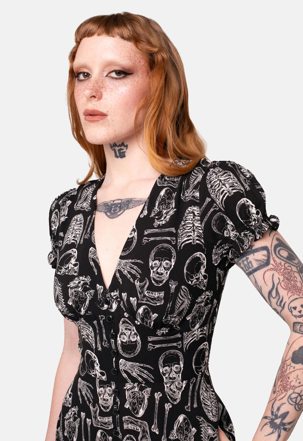 Anatomy Dress